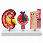 Kidney Section, Nephrons and Blood Vessels